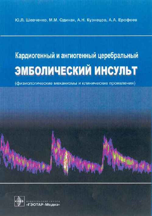 Кардиогенный и ангиогенный церебральный эмболический инсульт