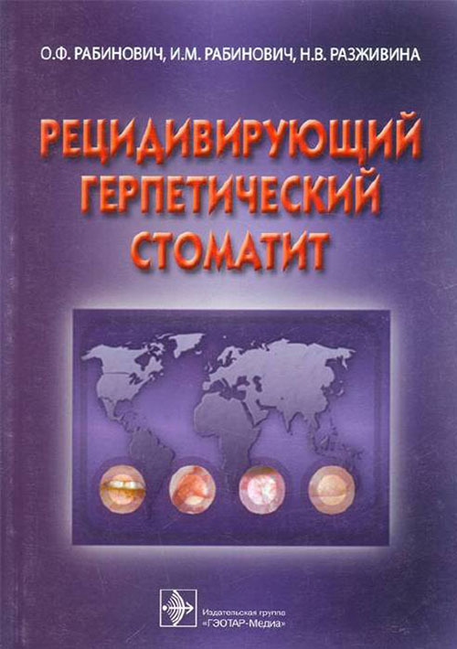 Рецидивирующий герпетический стоматит