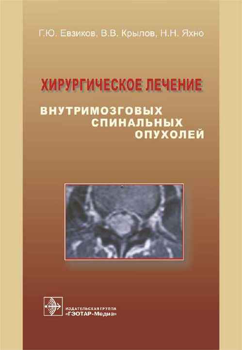Хирургическое лечение внутримозговых спинальных опухолей