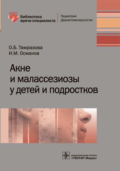 Акне и малассезиозы у детей и подростков. Библиотека врача-специалиста