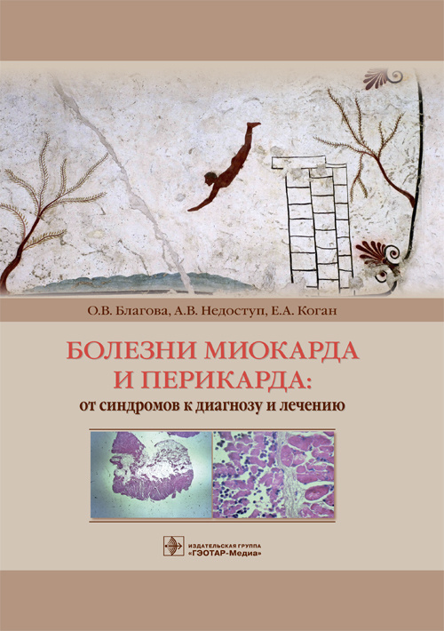 Болезни миокарда и перикарда. От синдромов к диагнозу и лечению