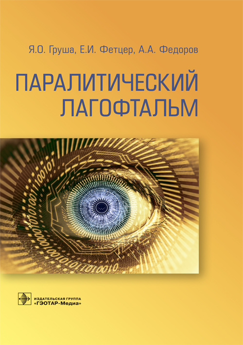 Паралитический лагофтальм