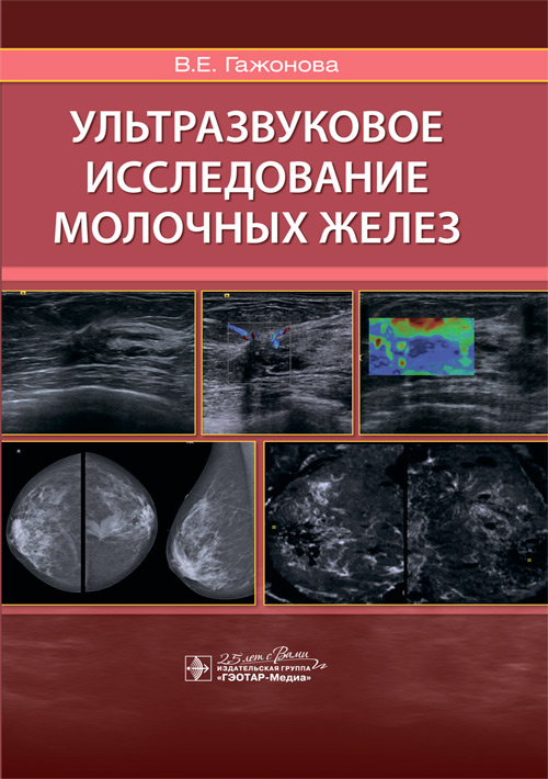 Ультразвуковое исследование молочных желез