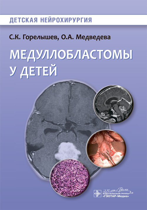 Медуллобластомы у детей. Детская нейрохирургия