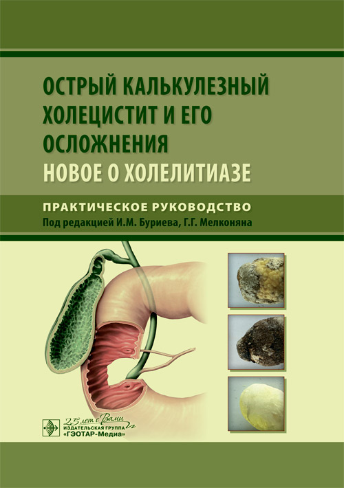 Острый калькулезный холецистит и его осложнения. Новое о холелитиазе. Руководство