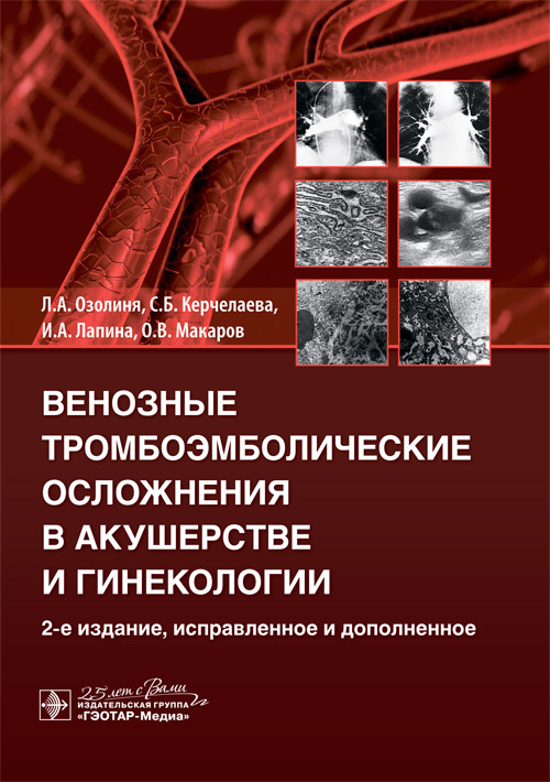 Венозные тромбоэмболические осложнения в акушерстве и гинекологии