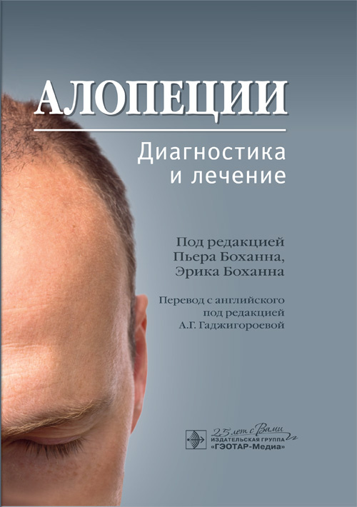 Алопеции. Диагностика и лечение