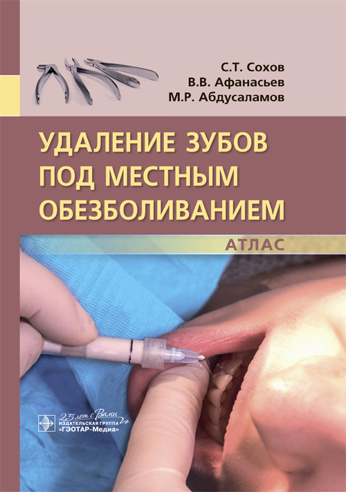 Удаление зубов под местным обезболиванием. Атлас