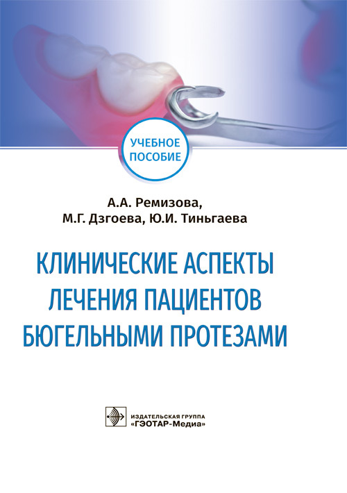Клинические аспекты лечения пациентов бюгельными протезами