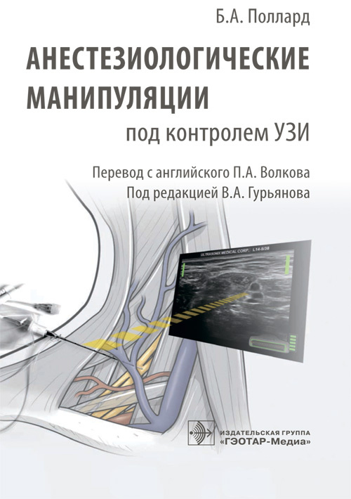 Анестезиологические манипуляции под контролем УЗИ