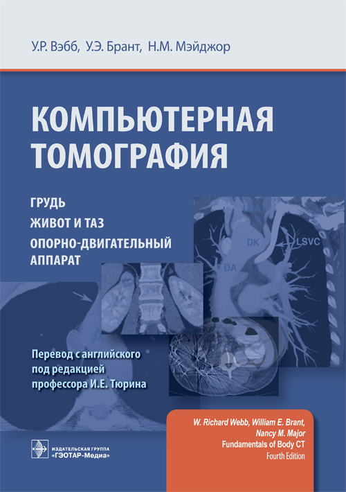 Компьютерная томография. Грудь, живот и таз, опорно-двигательный аппарат