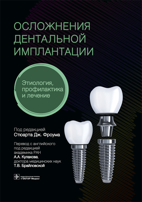 Осложнения дентальной имплантации. Этиология, профилактика и лечение