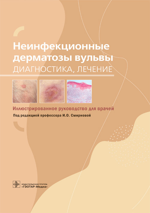 Неинфекционные дерматозы вульвы. Диагностика, лечение. Иллюстрированное руководство