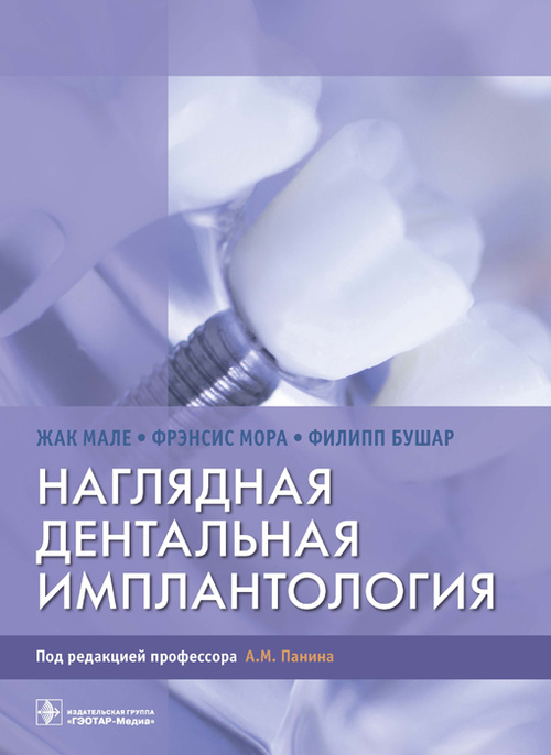 Наглядная дентальная имплантология