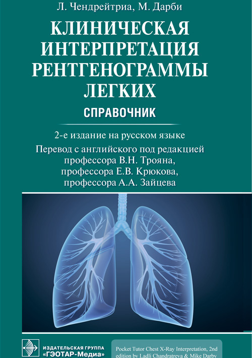 Клиническая интерпретация рентгенограммы легких. Справочник
