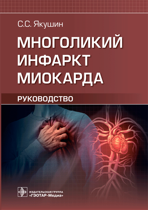 Многоликий инфаркт миокарда. Руководство