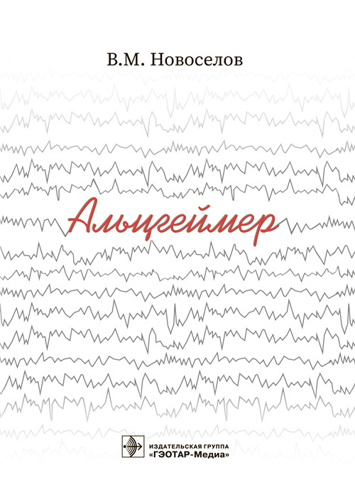 Альцгеймер