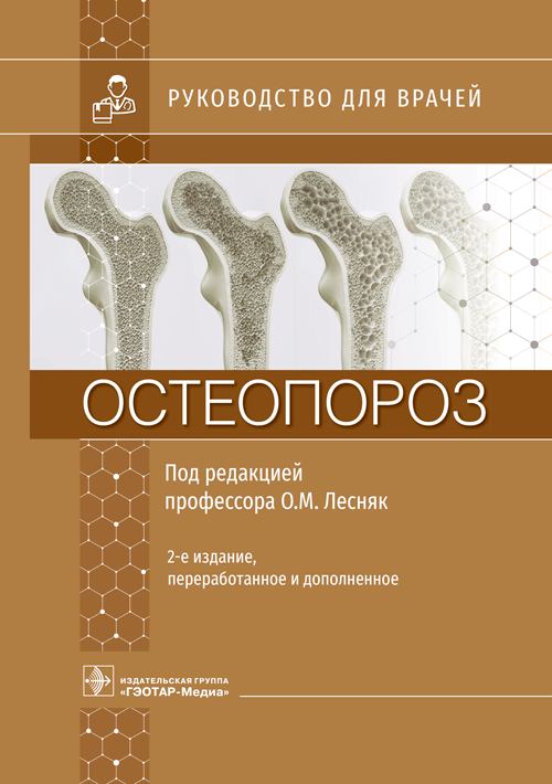 Остеопороз. Руководство