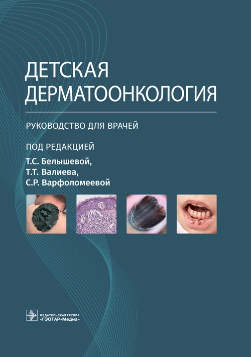 Детская дерматоонкология. Руководство