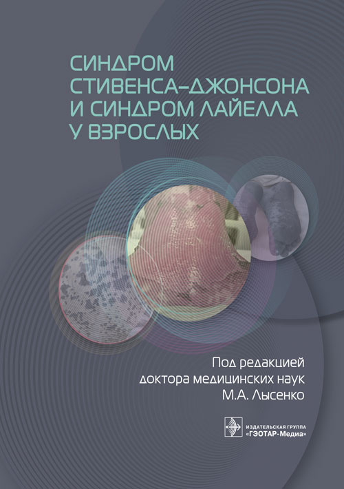 Синдром Стивенса-Джонсона и синдром Лайелла у взрослых