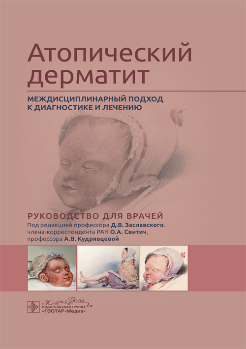 Атопический дерматит. Междисциплинарный подход к диагностике и лечению. Руководство
