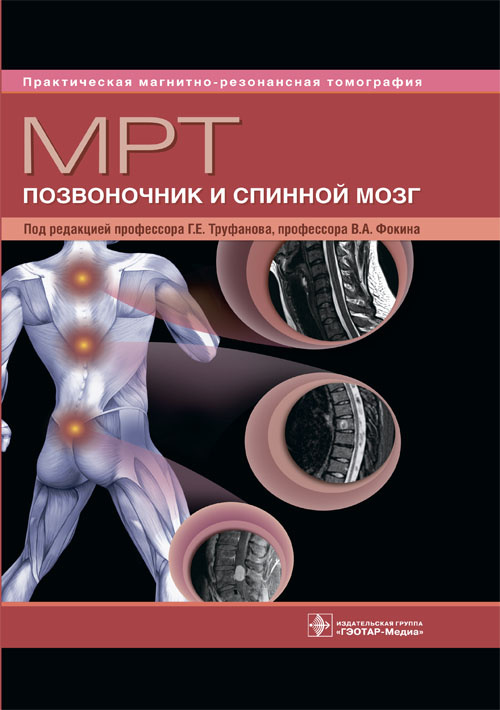 МРТ. Позвоночник и спинной мозг. Руководство для врачей