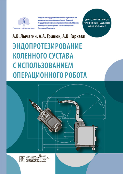 Эндопротезирование коленного сустава с использованием операционного робота. Учебное пособие
