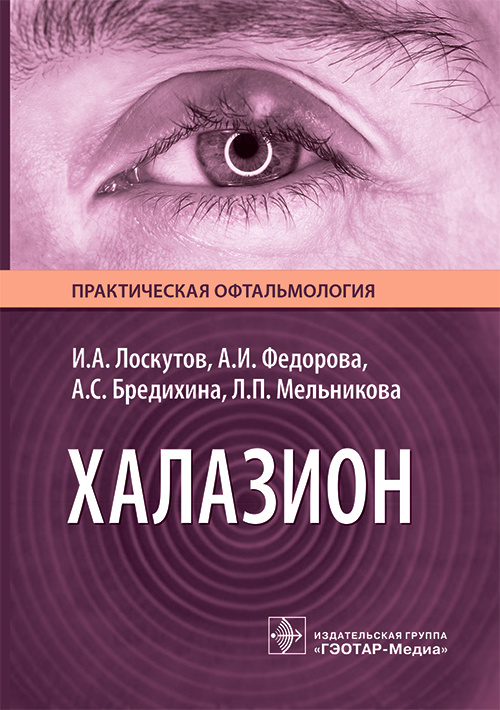 Халазион