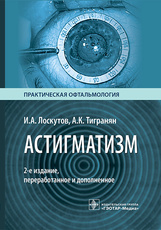 Астигматизм