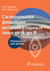Склеральная фиксация интраокулярных линз от А до Я. Руководство для врачей