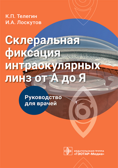 Склеральная фиксация интраокулярных линз от А до Я. Руководство для врачей