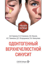 Одонтогенный верхнечелюстной синусит. Учебное пособие