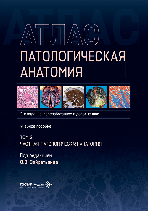 Патологическая анатомия. Атлас. Учебное пособие в 2-х томах. Том 2. Частная патологическая анатомия
