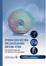 Лучевая диагностика при заболеваниях системы крови