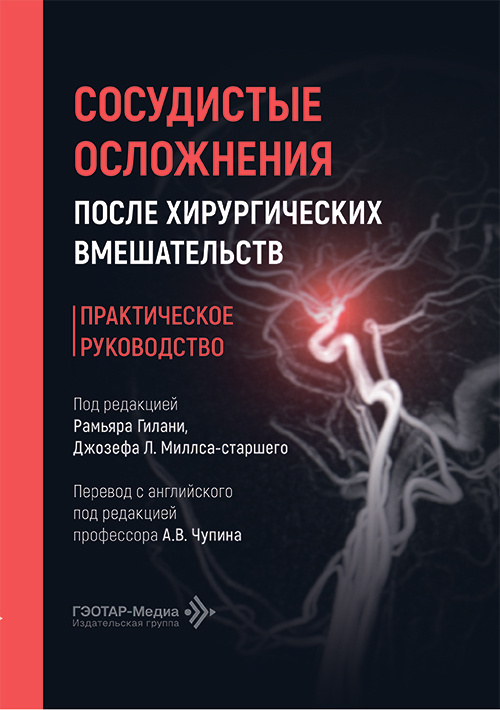 Сосудистые осложнения после хирургических вмешательств. Практическое руководство