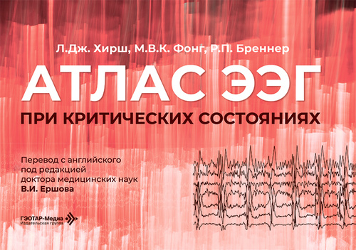 Атлас ЭЭГ при критических состояниях