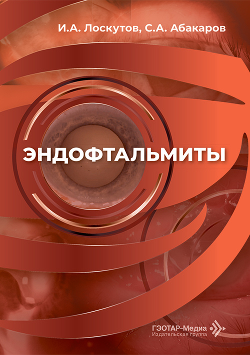 Эндофтальмиты