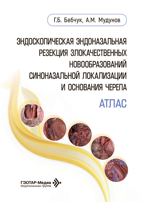 Эндоскопическая эндоназальная резекция злокачественных новообразований синоназальной локализации и основания черепа. Атлас