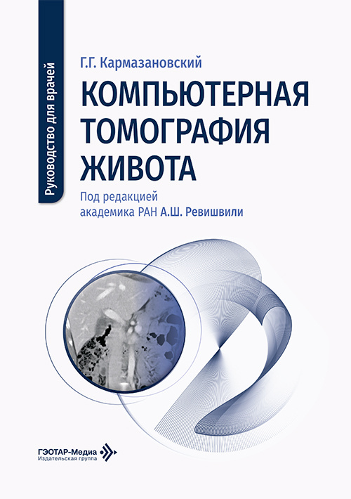 Компьютерная томография живота. Руководство для врачей