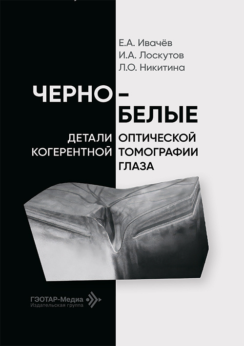Черно-белые детали оптической когерентной томографии глаза (читать на сайте эл.издание)