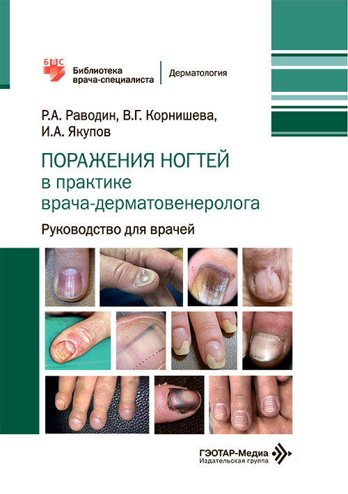 Поражения ногтей в практике врача-дерматовенеролога. Руководство для врачей