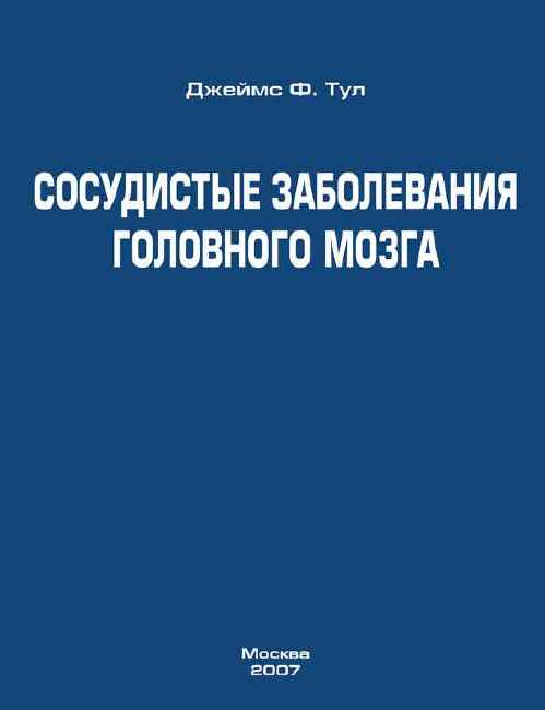 Сосудистые заболевания головного мозга