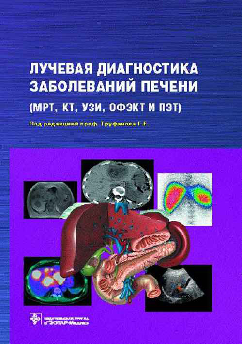 Лучевая диагностика заболеваний печени. Руководство