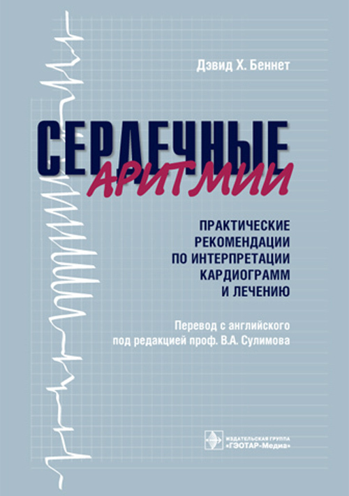 Сердечные аритмии