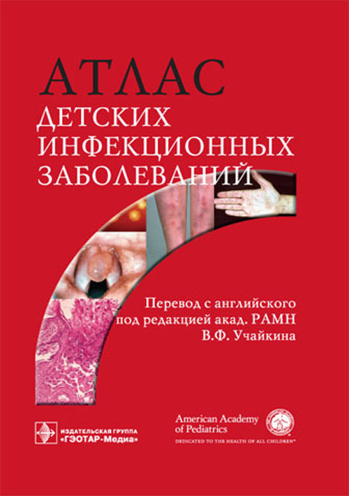 Атлас детских инфекционных заболеваний. Учебное пособие