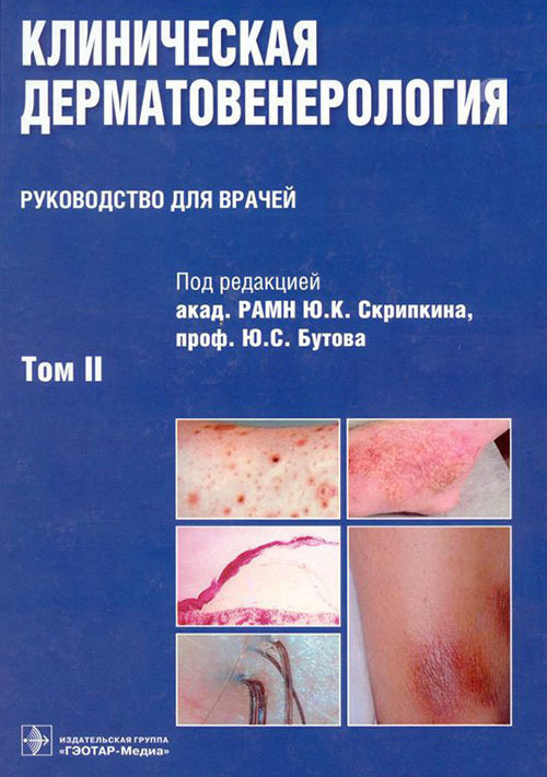 Клиническая дерматовенерология. Руководство в 2-х томах. Том 2