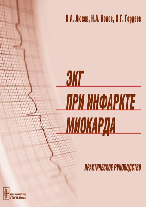 ЭКГ при инфаркте миокарда. Атлас