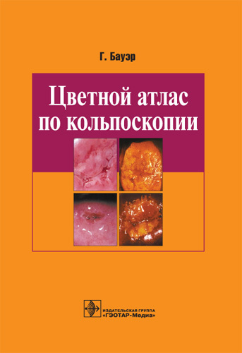 Цветной атлас по кольпоскопии