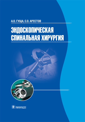 Эндоскопическая спинальная хирургия