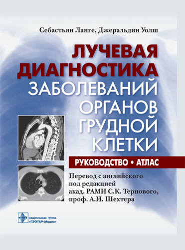 Лучевая диагностика заболеваний органов грудной клетки. Руководство
